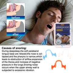 Anti Snore Nasal Dilator | Silicone Nose Clip for Better Sleep detail view
