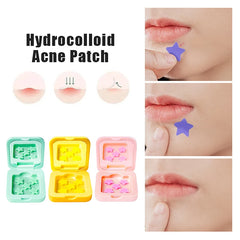 Star Shaped Hydrocolloid Acne Patches | Invisible Pimple Stickers with Mirror detail view