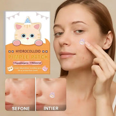 600 Pcs Cat Shaped Acne Patches | Hydrocolloid Pimple Stickers with Cute Design alternate view