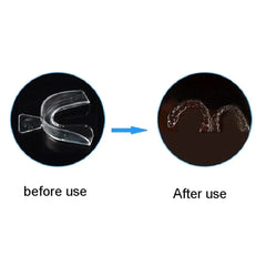 Mouth Guard for Teeth Grinding | Anti Snoring Sleep Aid close-up view