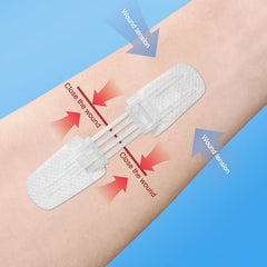 Zipper Bandage Wound Closure Patch | Suture-Free First Aid Dressing alternate view