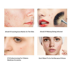 Acne Pimple Patch Invisible Waterproof | Hydrocolloid Spot Treatment for Blemishes close-up view