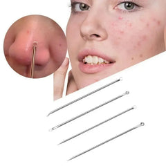 Stainless Steel Beauty Needle Acne Remover Set 4 Pcs
