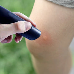 Electronic Insect Bite Relief Pen | Heat Pulse Itch Stopper close-up view