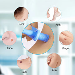 3-IN-1 Painless Skin Tag Removal Kit | Skin Label, Mole, Acne & Wart Removal Pen Set alternate view