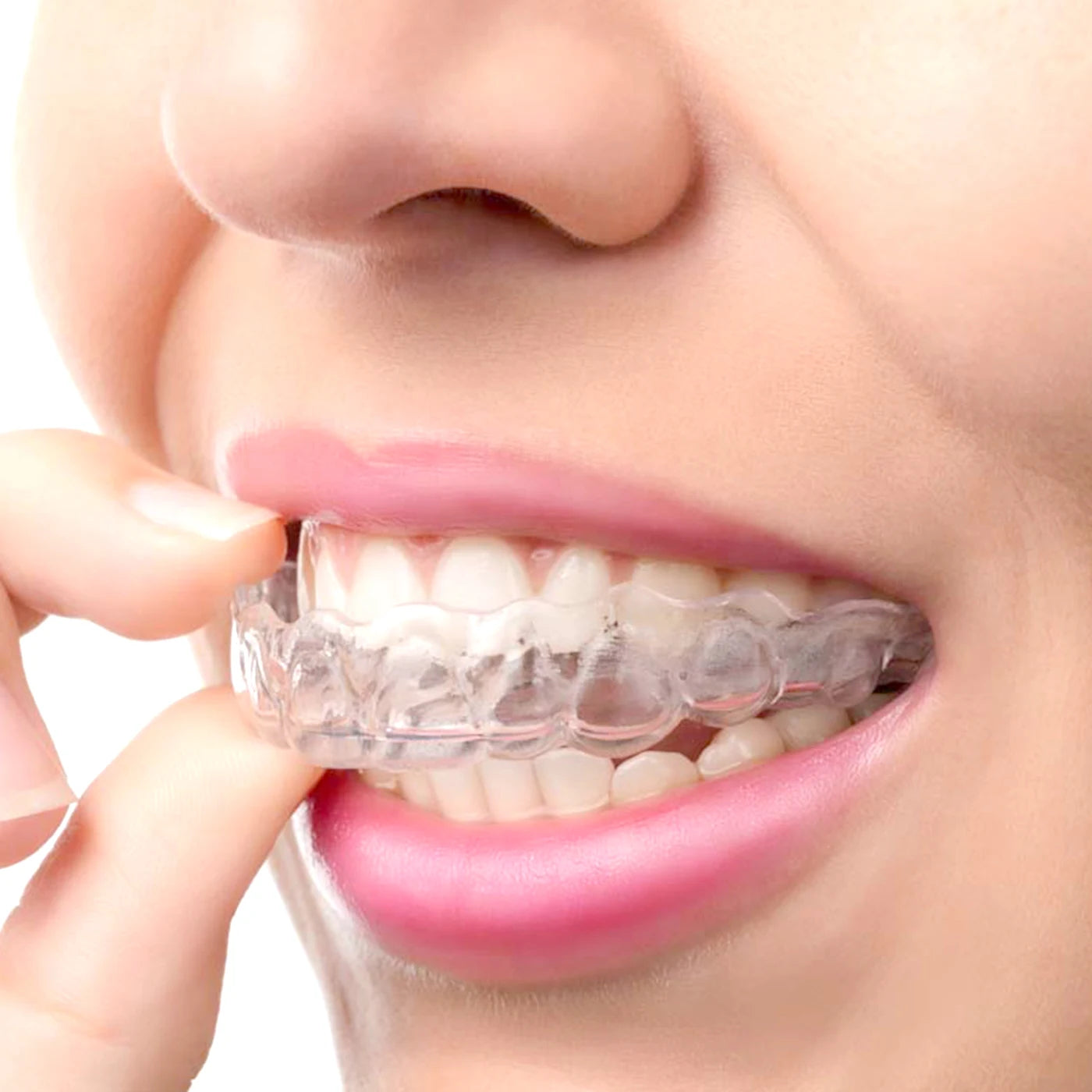 Sleeping Mouth Guard for Snoring and Bruxism | Anti Snore Mouthpiece for Better Sle additional angle