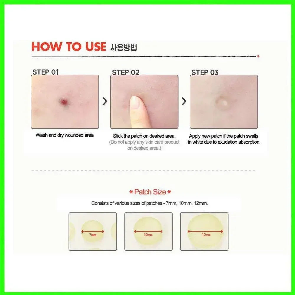 24 Pcs Hydrocolloid Acne Patches | Pimple Spot Treatment Stickers for Face close-up view