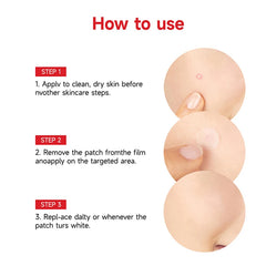 24pcs/36pcs Round Hydrogel Invisible Acne Sticker | Makeup and Skincare Tool close-up view