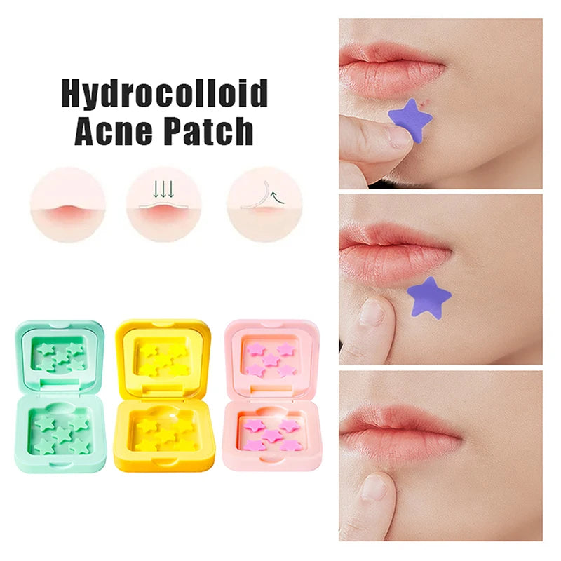 Star Shaped Hydrocolloid Acne Patches | Invisible Pimple Stickers with Mirror detail view