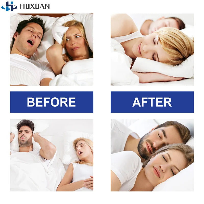 Stop Snoring Patch | Gentle Mouth Tape for Better Sleep and Nose Breathing alternate view