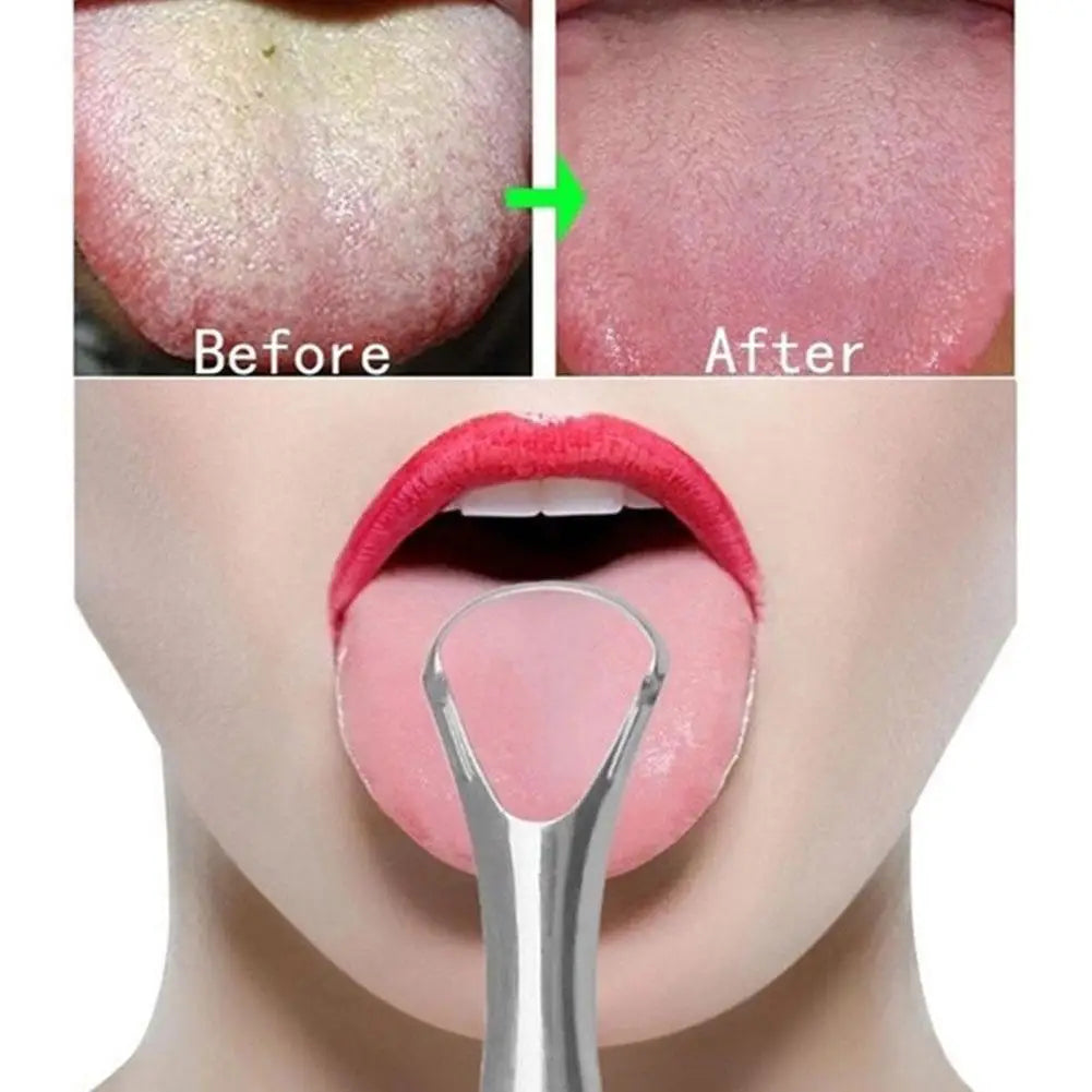 1Pcs Portable Single Layer Tongue Scraper Reusable Stainless Steel Oral Mouth Brush Tong detail view