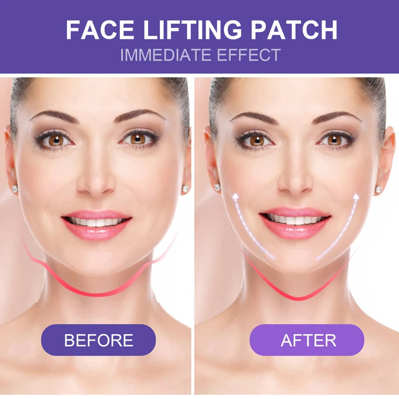 Face Lift Tape | Invisible V-Shape Face Lifting Sticker additional angle