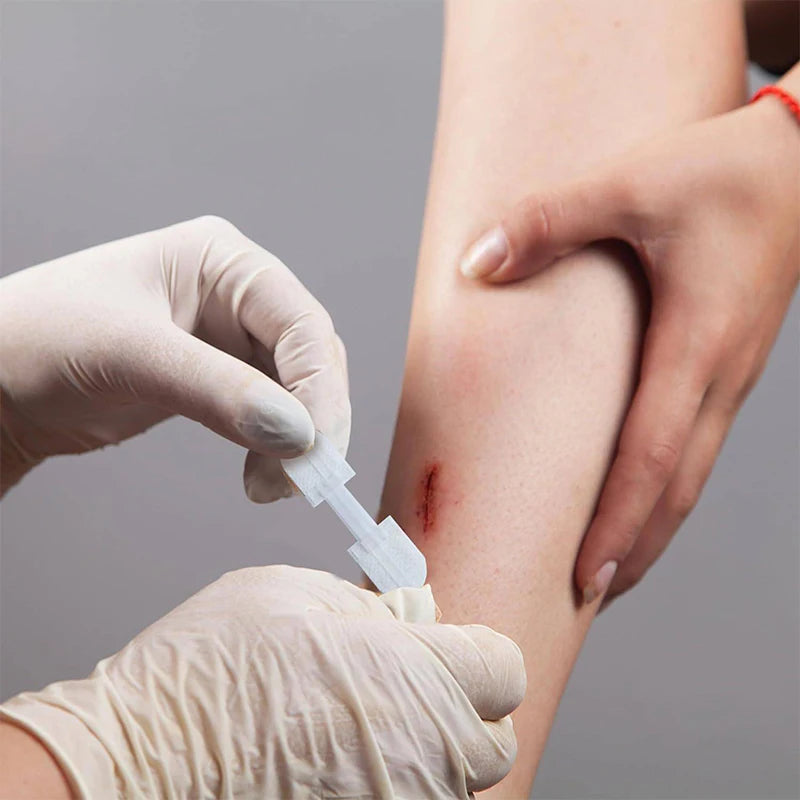 Zipper Bandage Wound Closure Patch | Suture-Free First Aid Dressing detail view