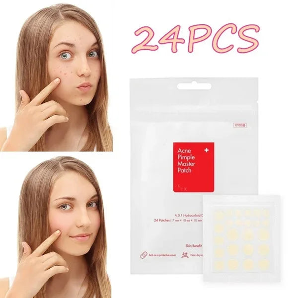 24 Pcs Hydrocolloid Acne Patches | Pimple Spot Treatment Stickers for Face alternate view