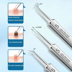Ultra-Fine Blackhead Remover Tweezers | Precision Acne Extraction Tool alternate view