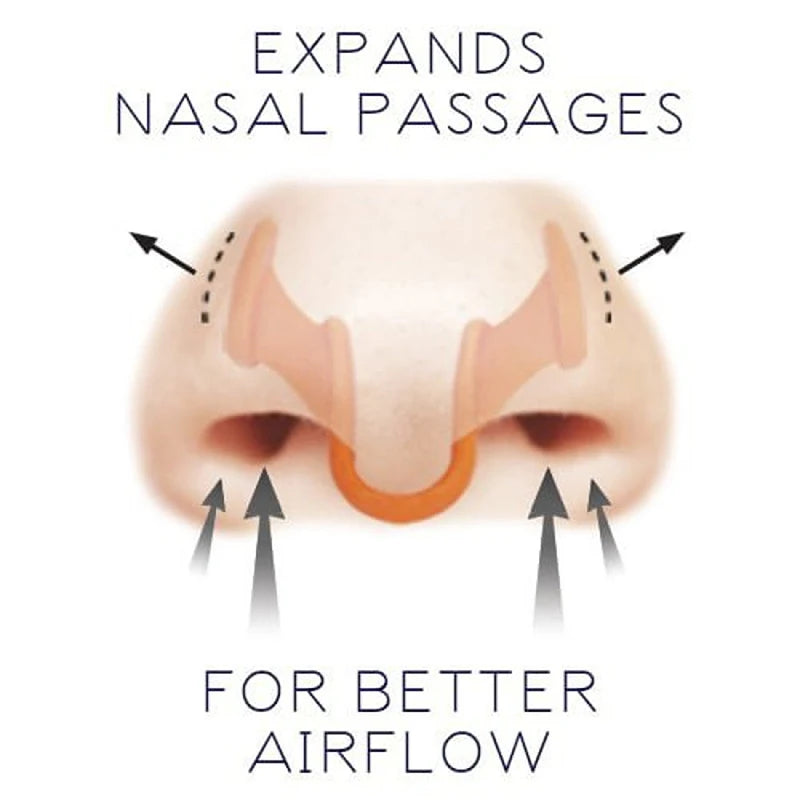 10Pcs Silicone Nose Dilator for Snoring | Anti Snoring Nasal Clip Set close-up view