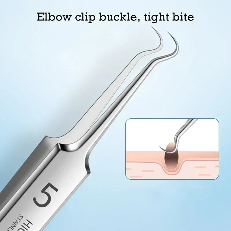 Ultra-Fine Blackhead Remover Tweezers | Precision Acne Extraction Tool close-up view