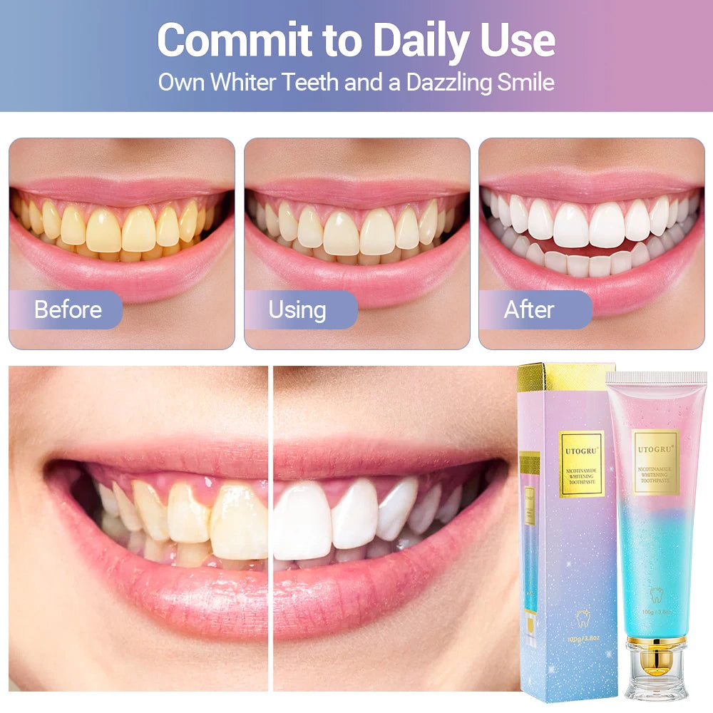 Whitening Toothpaste – Oral Care for Plaque Removal and Fresh Breath