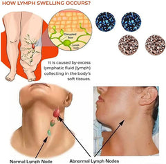 Magnetology Lymphvity Germanium Earrings | Non Piercing Magnetic Acupressure Ear Studs detail view
