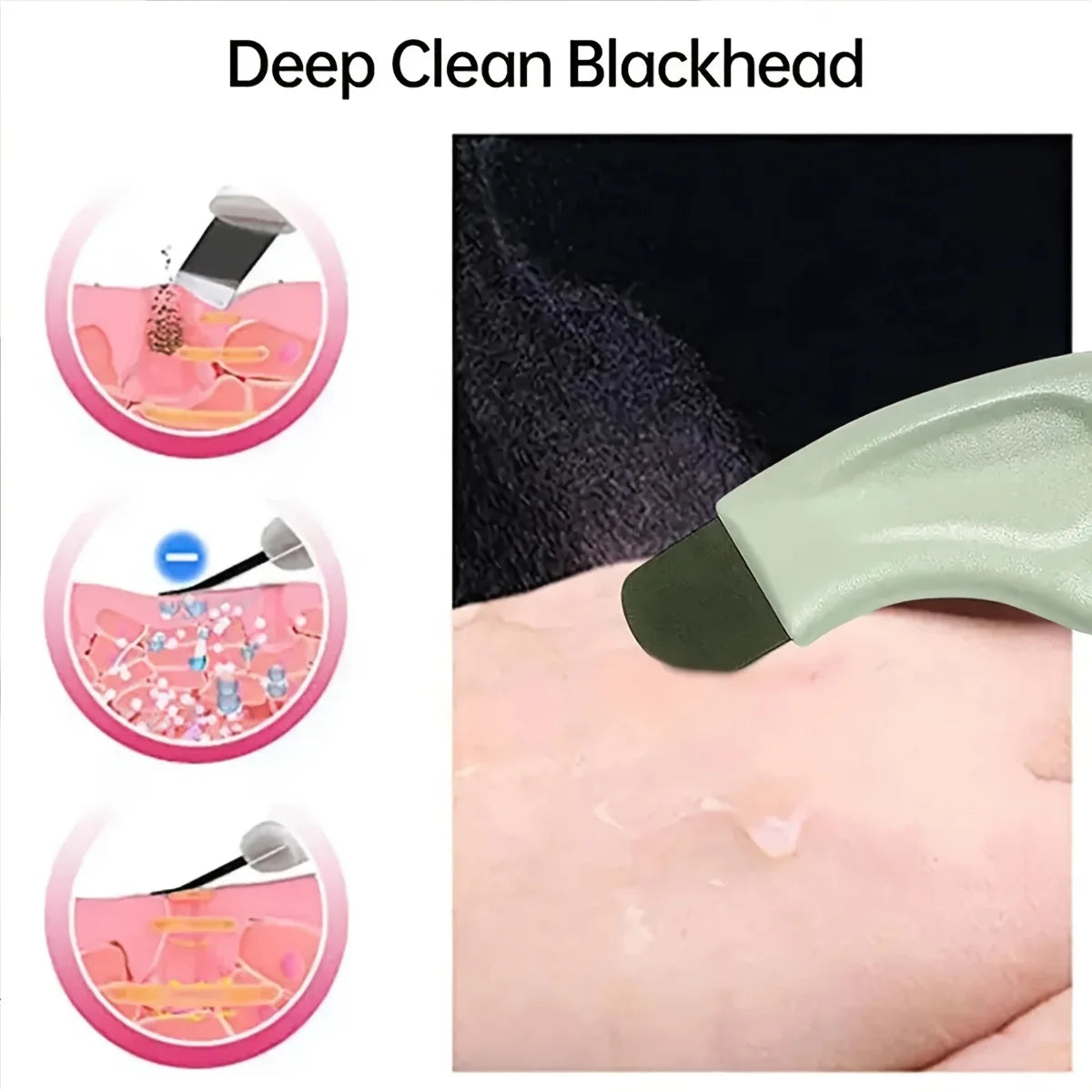 Facial Blackhead Removal Tool | Nose Deep Cleansing Skincare Tool lifestyle view