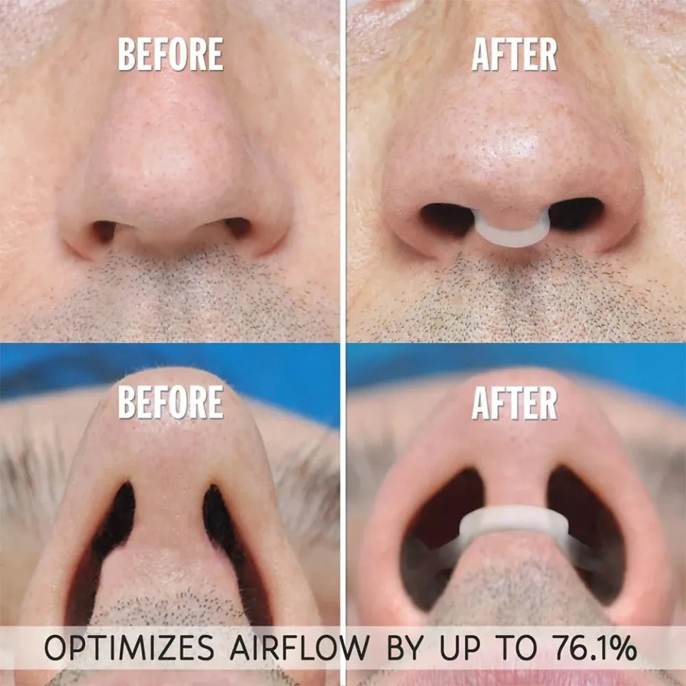 Anti Snoring Nose Clip | Gentle Sleep Aid for Men and Women additional angle