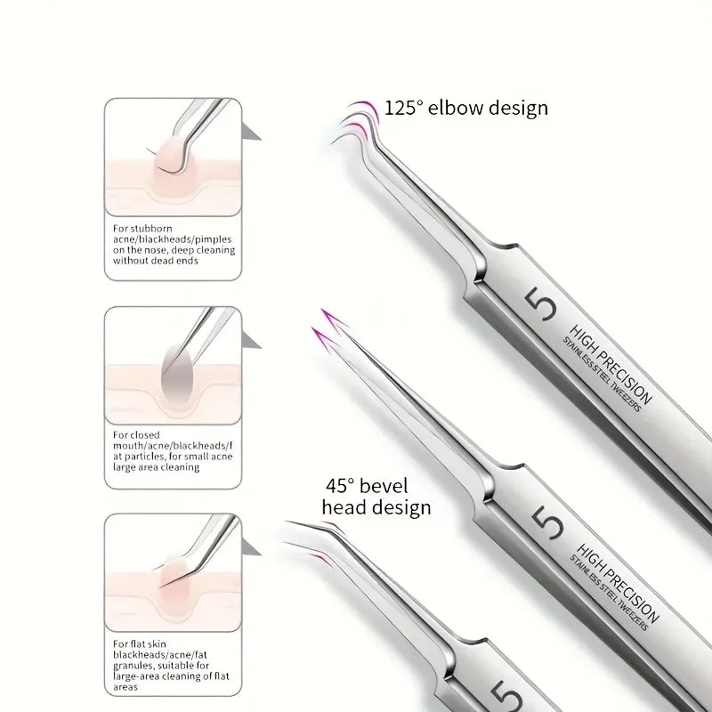 1/3pcs Extra Fine No. 5 Cellular Acne Blackhead Tweezers | Facial Beauty Tool for Skin C detail view