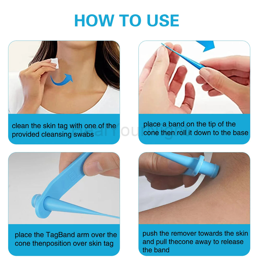 3-IN-1 Painless Skin Tag Removal Kit | Skin Label, Mole, Acne & Wart Removal Pen Set wit detail view