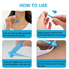 3-IN-1 Painless Skin Tag Removal Kit | Skin Label, Mole, Acne & Wart Removal Pen Set wit detail view