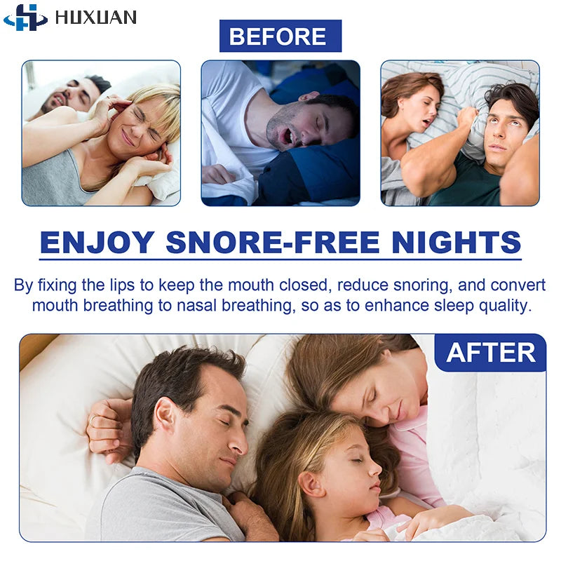 Stop Snoring Patch | Gentle Mouth Tape for Better Sleep and Nose Breathing detail view