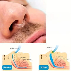 Super Soft Anti-Snoring Device | Nose Hanging Clip for Quiet Sleep alternate view