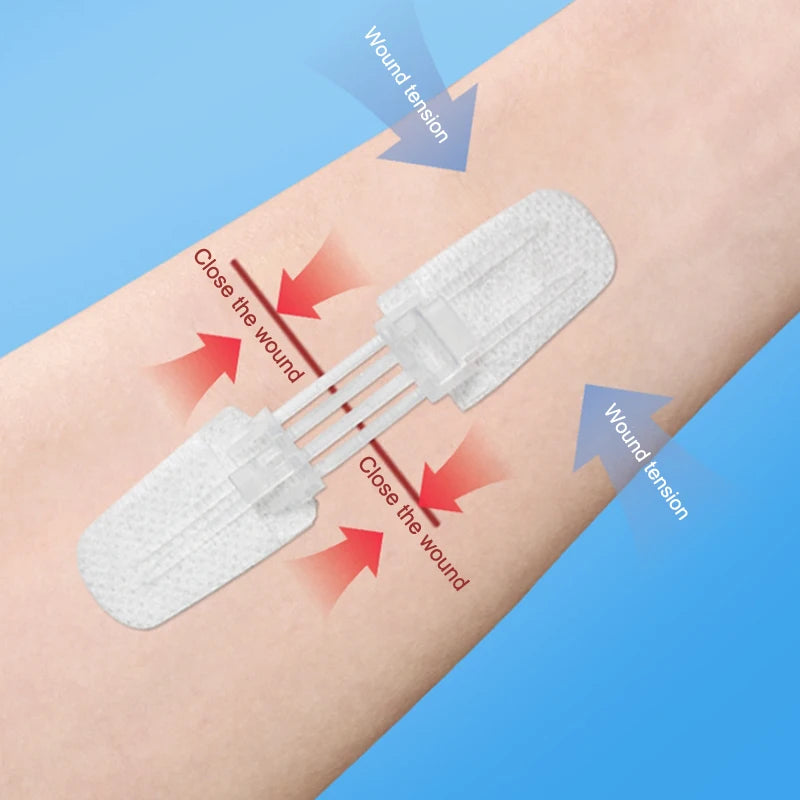 Zipper Bandage Wound Closure Patch | Suture-Free First Aid Dressing alternate view