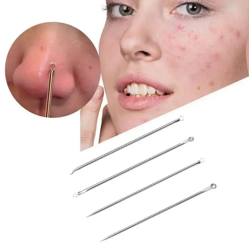 Stainless Steel Beauty Needle Acne Remover Set 4 Pcs