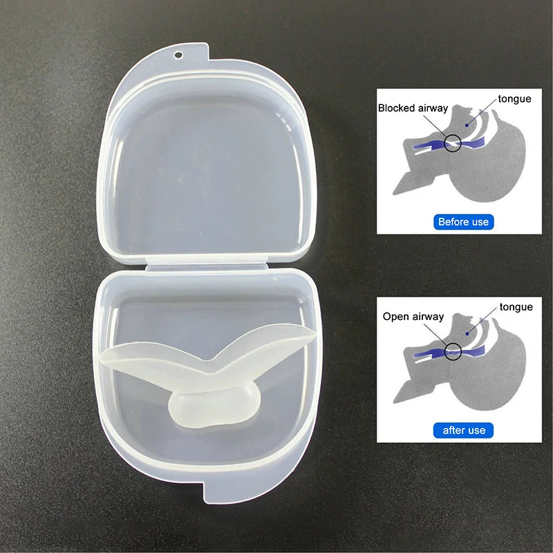 Tongue Retaining Mouthpiece for Snoring Relief | Medical Silicone Sleep Aid close-up view