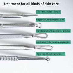 Stainless Steel Blackhead Remover Tool Kit | Professional Facial Cleanser Set with Sto close-up view
