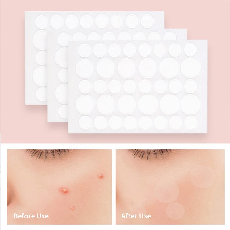 Acne Pimple Patch Invisible Waterproof | Hydrocolloid Spot Treatment for Blemishes detail view