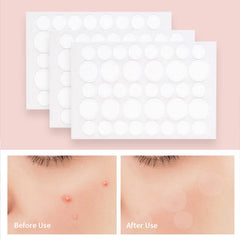 Acne Pimple Patch Invisible Waterproof | Hydrocolloid Spot Treatment for Blemishes detail view