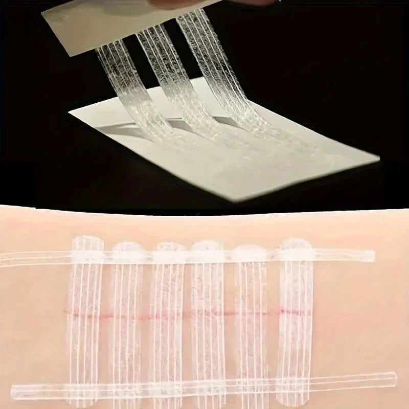 5 Strips Wound Skin Closure Strips | Medical Suture Free Surgical Tape detail view