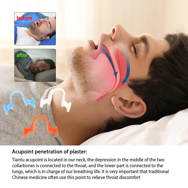 Nasal Dilator for Snoring | Stop Snoring Aid for Better Sleep close-up view