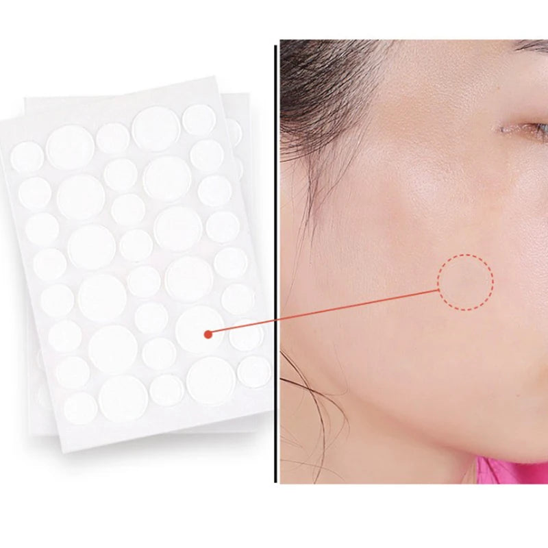 Acne Pimple Patch Invisible Waterproof | Hydrocolloid Spot Treatment for Blemishes alternate view