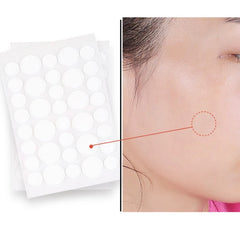 Acne Pimple Patch Invisible Waterproof | Hydrocolloid Spot Treatment for Blemishes alternate view