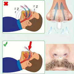 Mini Nasal Expander | Portable Anti-Snoring Nose Clip for Better Sleep close-up view