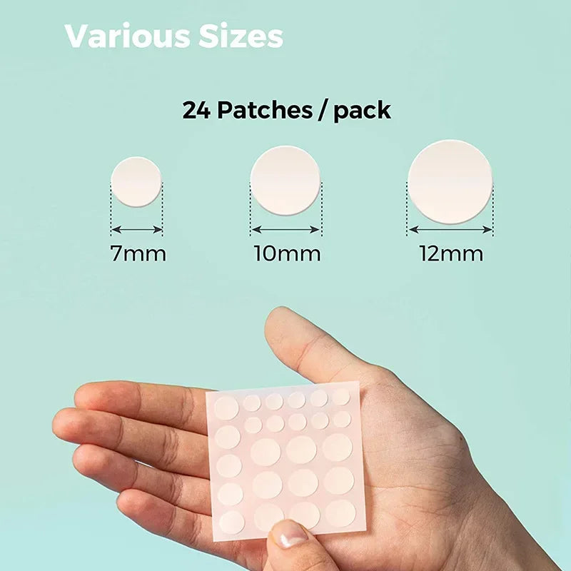 24 Pcs Hydrocolloid Acne Patches | Pimple Spot Treatment Stickers for Face lifestyle view