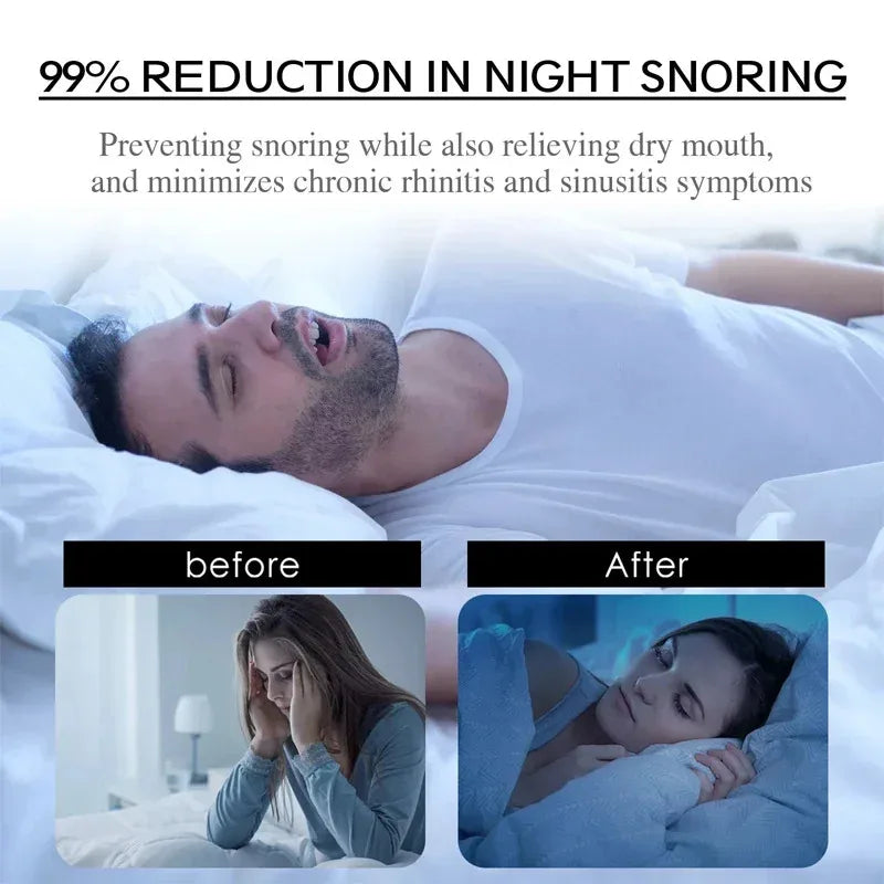 Anti-Snoring Mouth Patches | Sleep Tape for Nasal Breathing lifestyle view