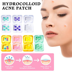 Star Shaped Hydrocolloid Acne Patches | Invisible Pimple Stickers with Mirror alternate view