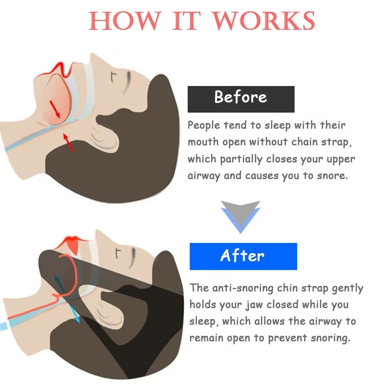Anti Snore Chin Strap | Sleep Aid for Snoring Relief additional angle