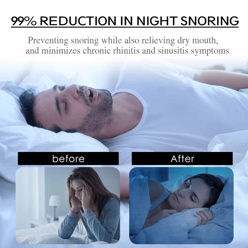 50pcs Black Mouth Tape for Snoring | Anti-Snore Sleep Aid additional angle