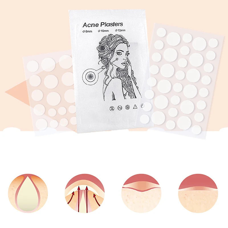 24pcs/36pcs Round Hydrogel Invisible Acne Sticker | Makeup and Skincare Tool lifestyle view