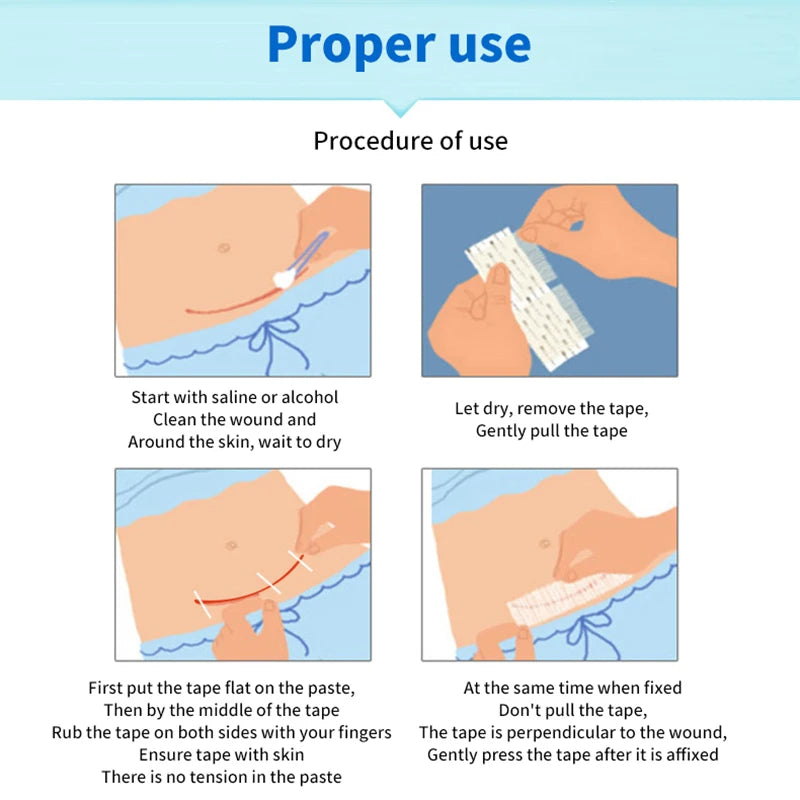 5 Strips Wound Skin Closure Strips | Medical Suture Free Surgical Tape close-up view