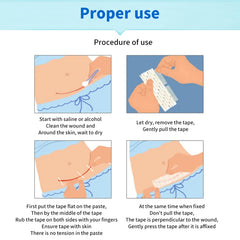 5 Strips Wound Skin Closure Strips | Medical Suture Free Surgical Tape close-up view