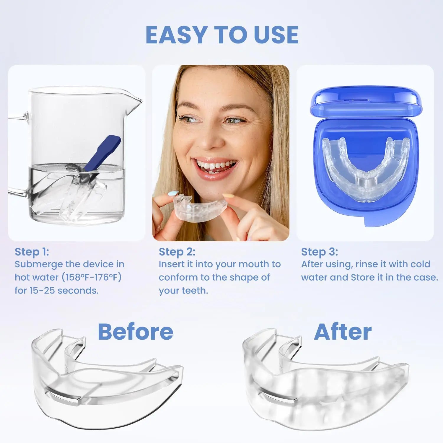 Sleep Mouth Guard for Snoring and Bruxism | Anti Snore Mouthpiece lifestyle view